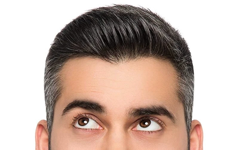Know What To Do If You Have White Hairr | SkynOptik - Slay Grey Hair Serum