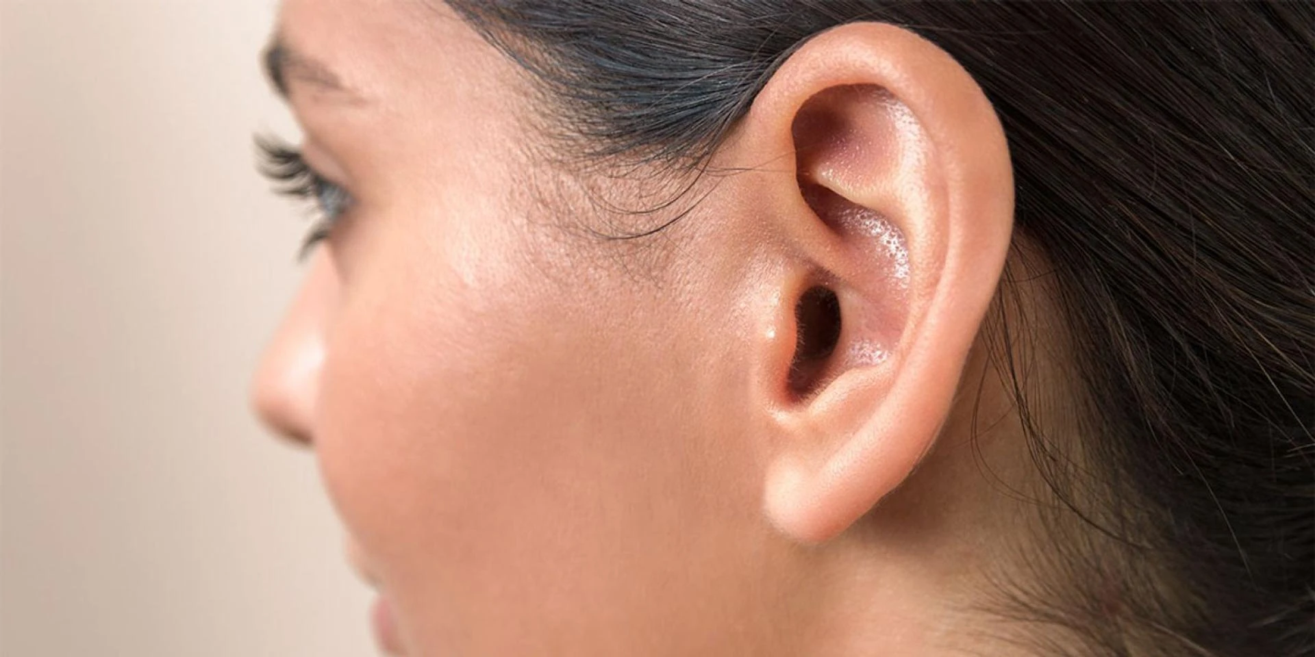 Navigating the Challenges of Excessive Earwax: A Comprehensive Guide