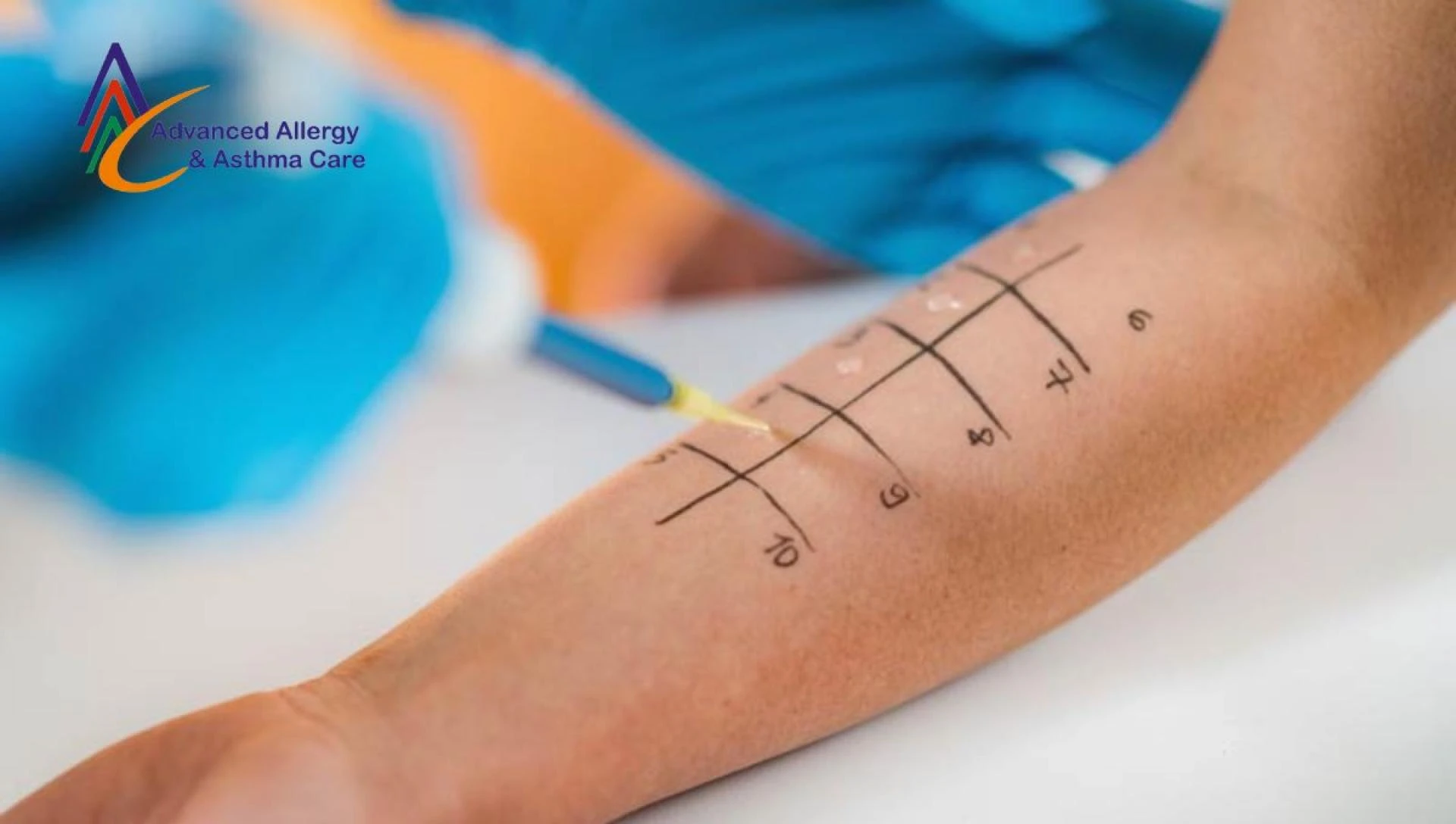 Understanding Allergy Skin Tests: A Step-by-Step Overview