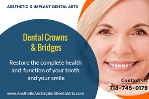 Find a dentist that performs crowns and bridges