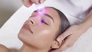 Microdermabrasion