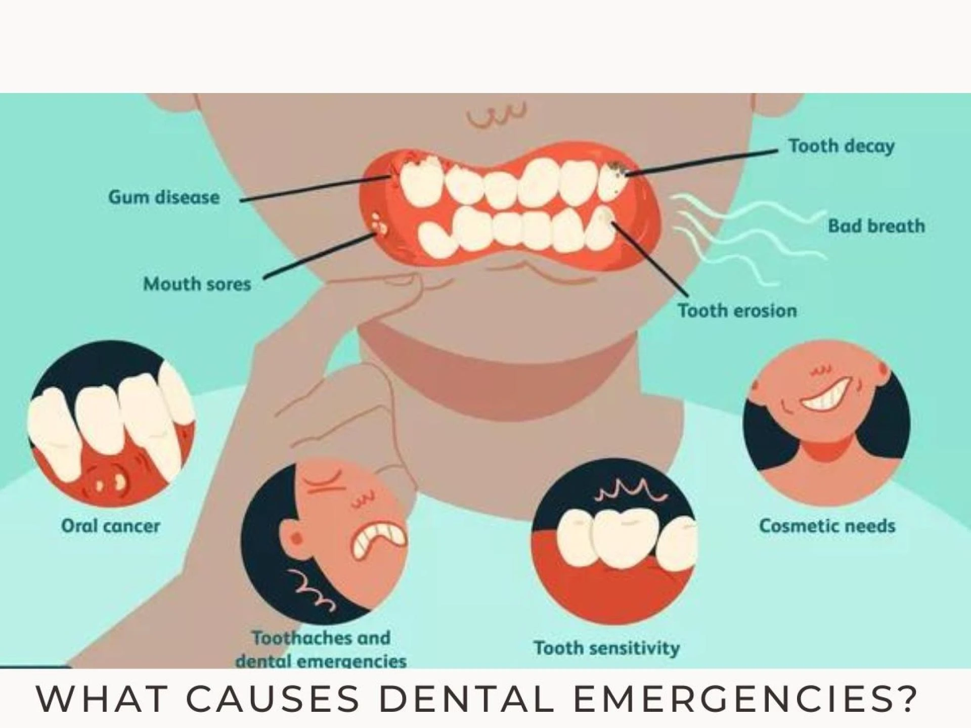 What causes dental emergencies?
