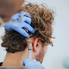 Facial Pigmentation Treatment - How to Get Rid of Those Blotches That Make You Cringe