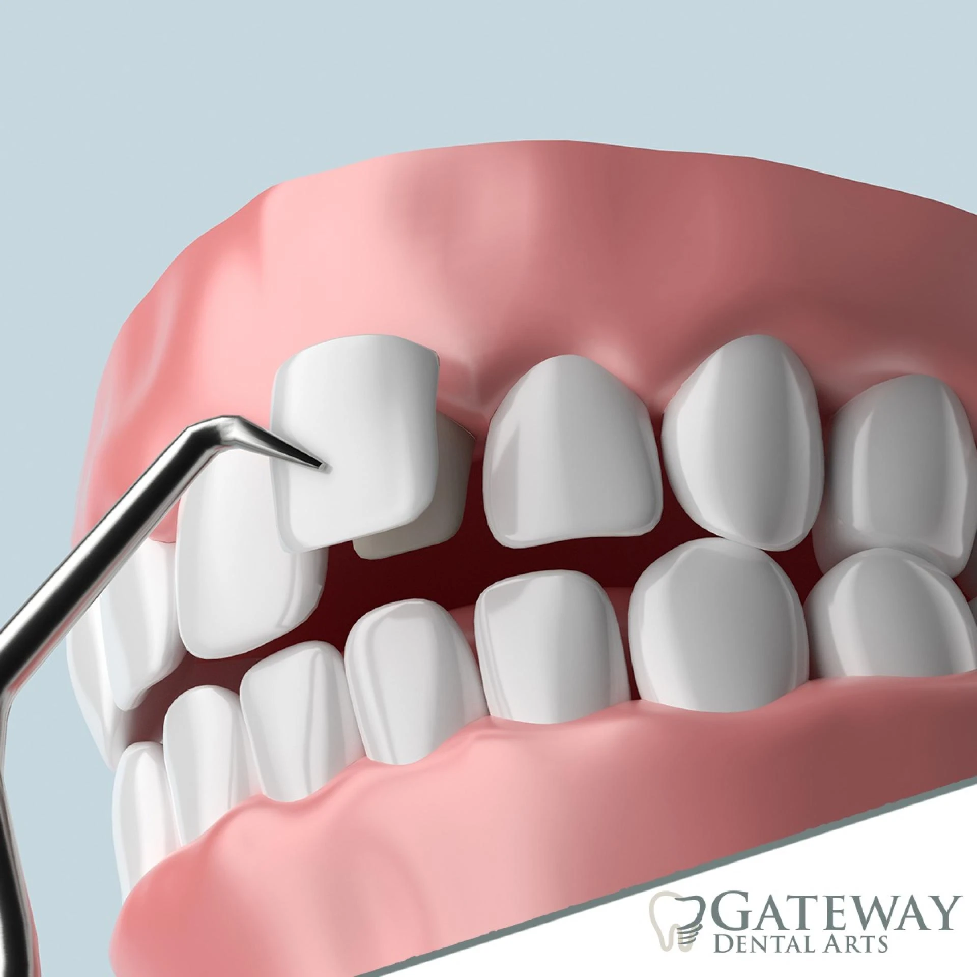 Mastering the Art of Beauty: Cosmetic Dentist in Salt Lake City