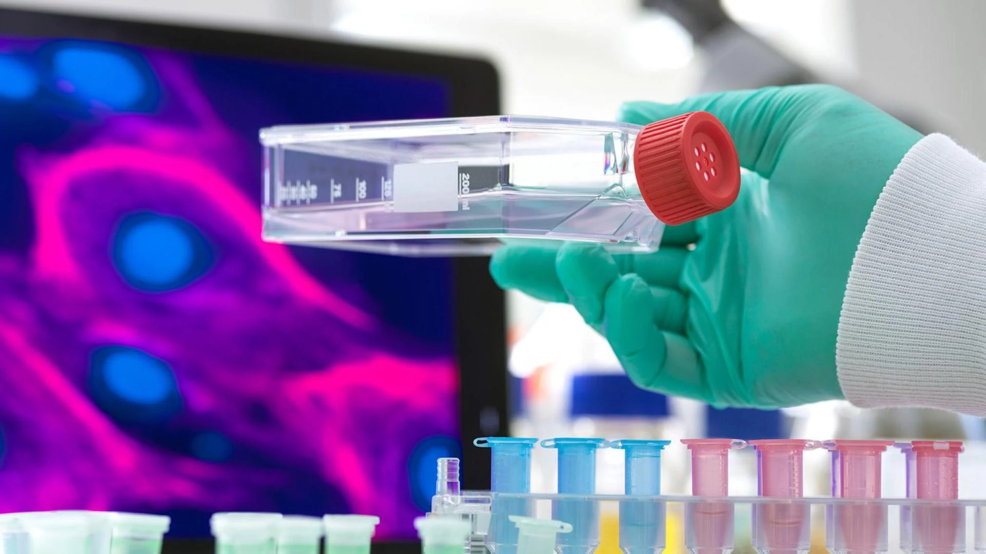 IS STEM CELL TREATMENT EFFECTIVE FOR HIP AND KNEE OSTEOARTHRITIS?