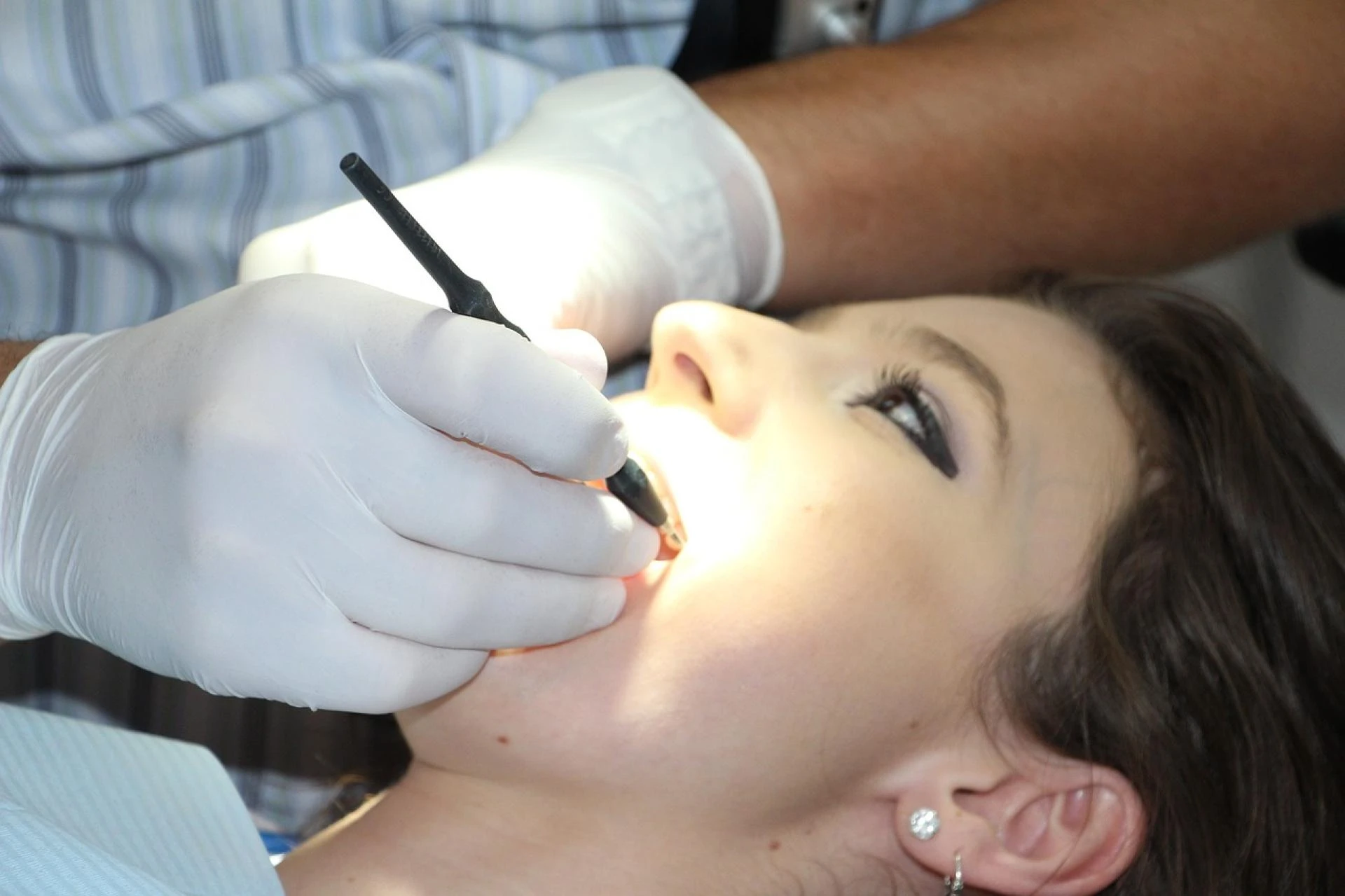 Why Do I Need My Wisdom Teeth to Be Removed?