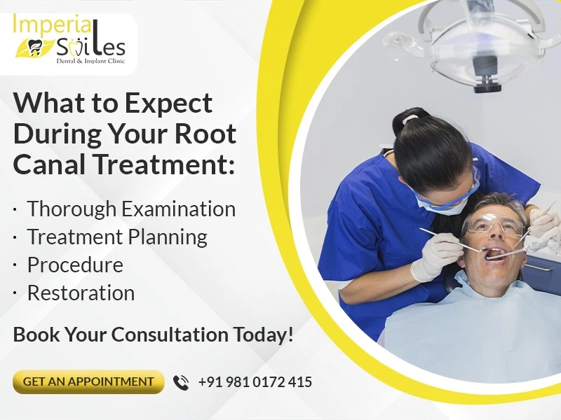 The Root Canal Treatment: Facts You Need to Understand