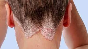 Best physiotherapy centre Delhi