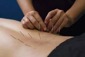 Physiotherapy Clinic in Chattarpur, Delhi