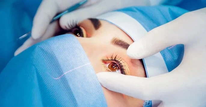 What to Expect Before, During and After Retina Surgery