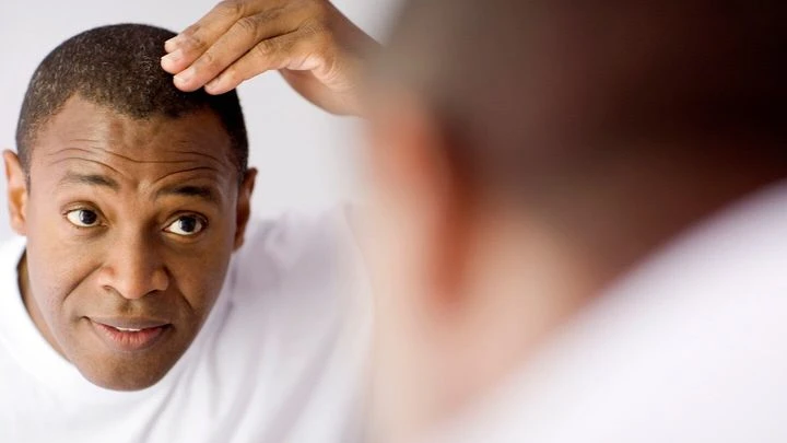 What Does DHT Have To Do With Hair Loss?