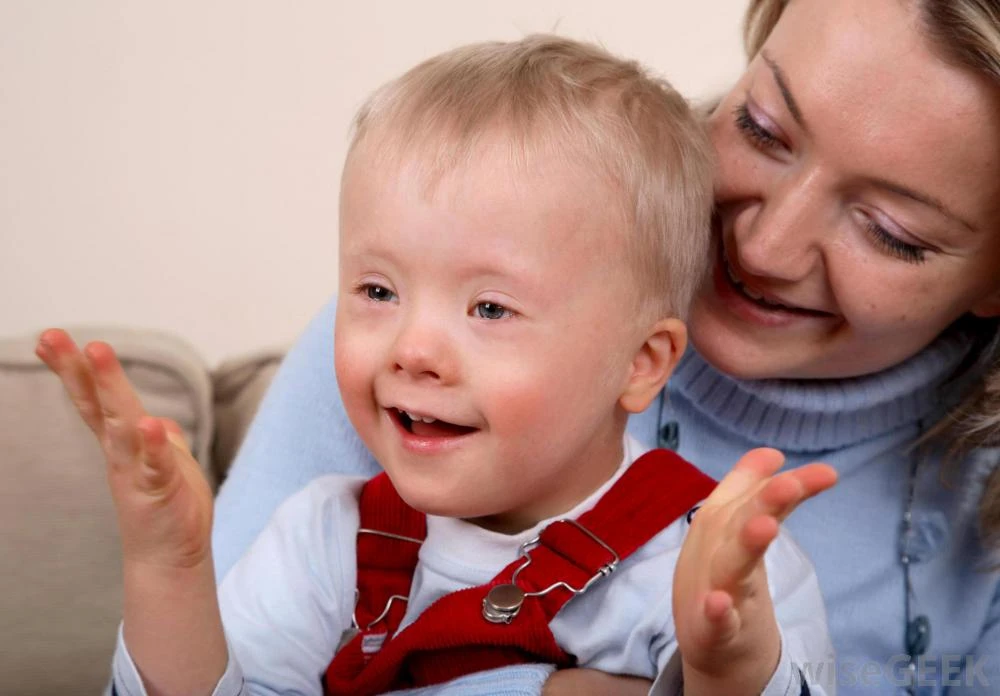 How is Down Syndrome Treated and Diagnosed Among Children?