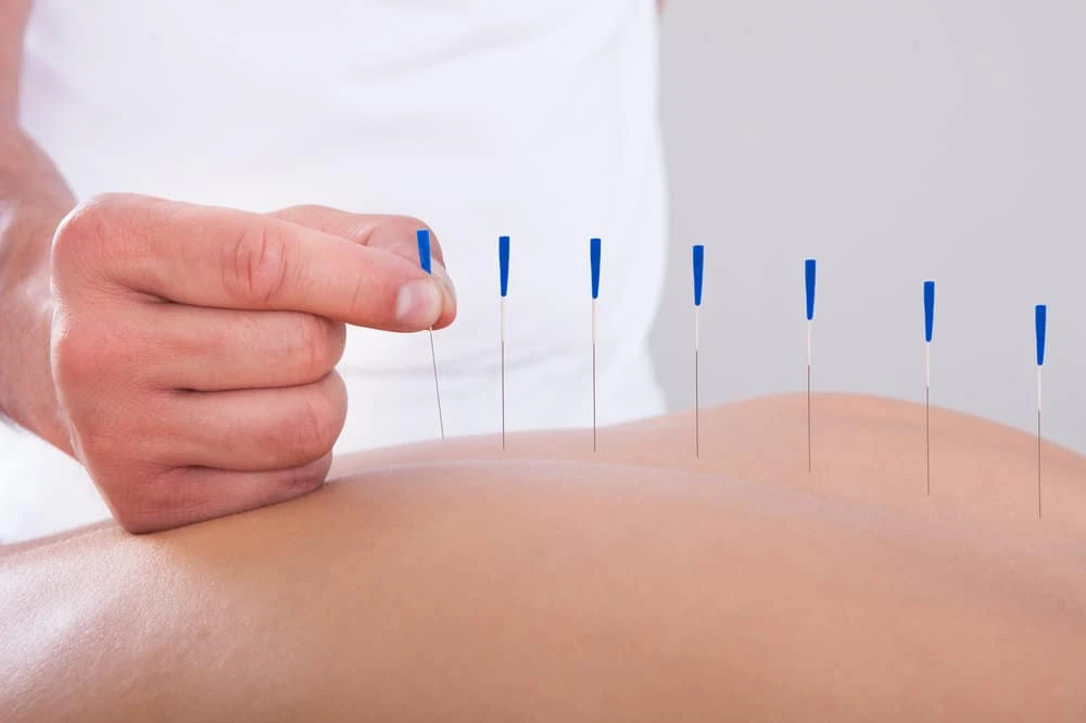 Long Term Benefits of Acupuncture