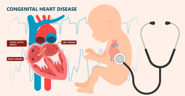 Understanding Congenital Heart Disease: Causes, Symptoms, Diagnosis, and Treatment