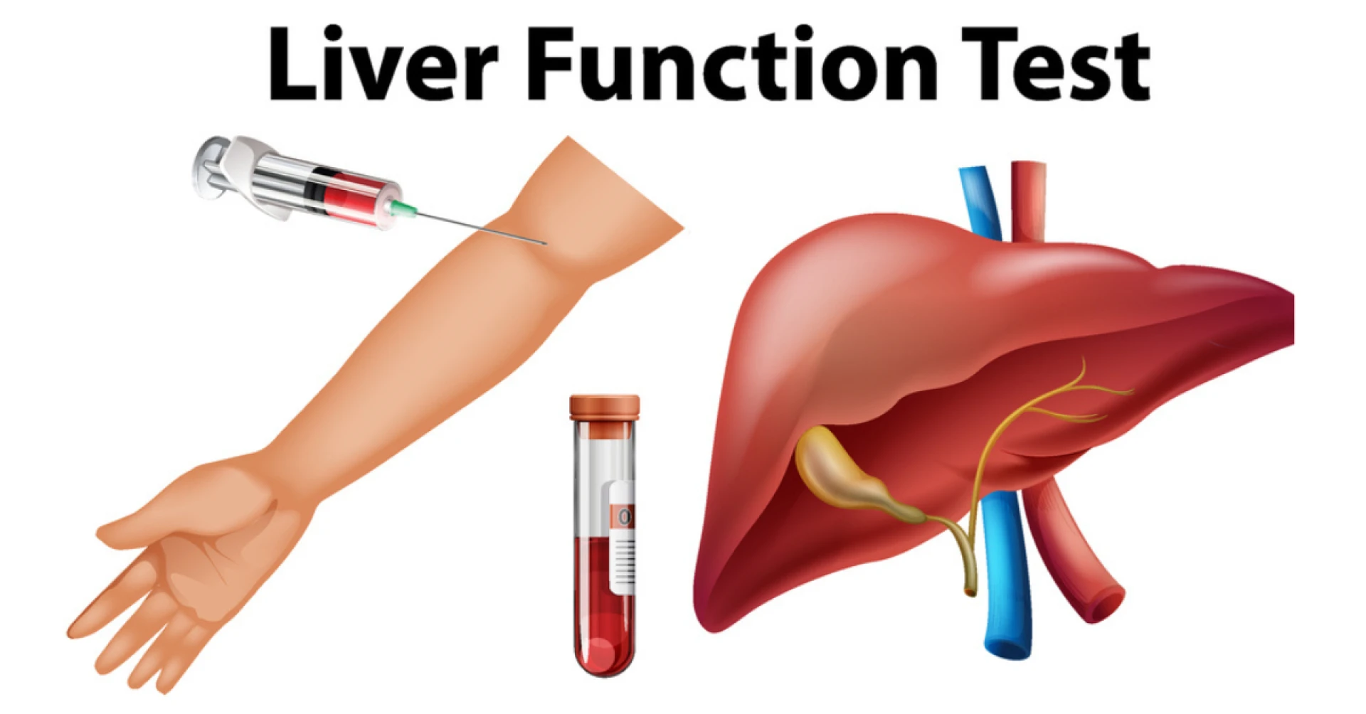 The Role of Liver Function Tests: Understanding Why They are Vital for Your Health