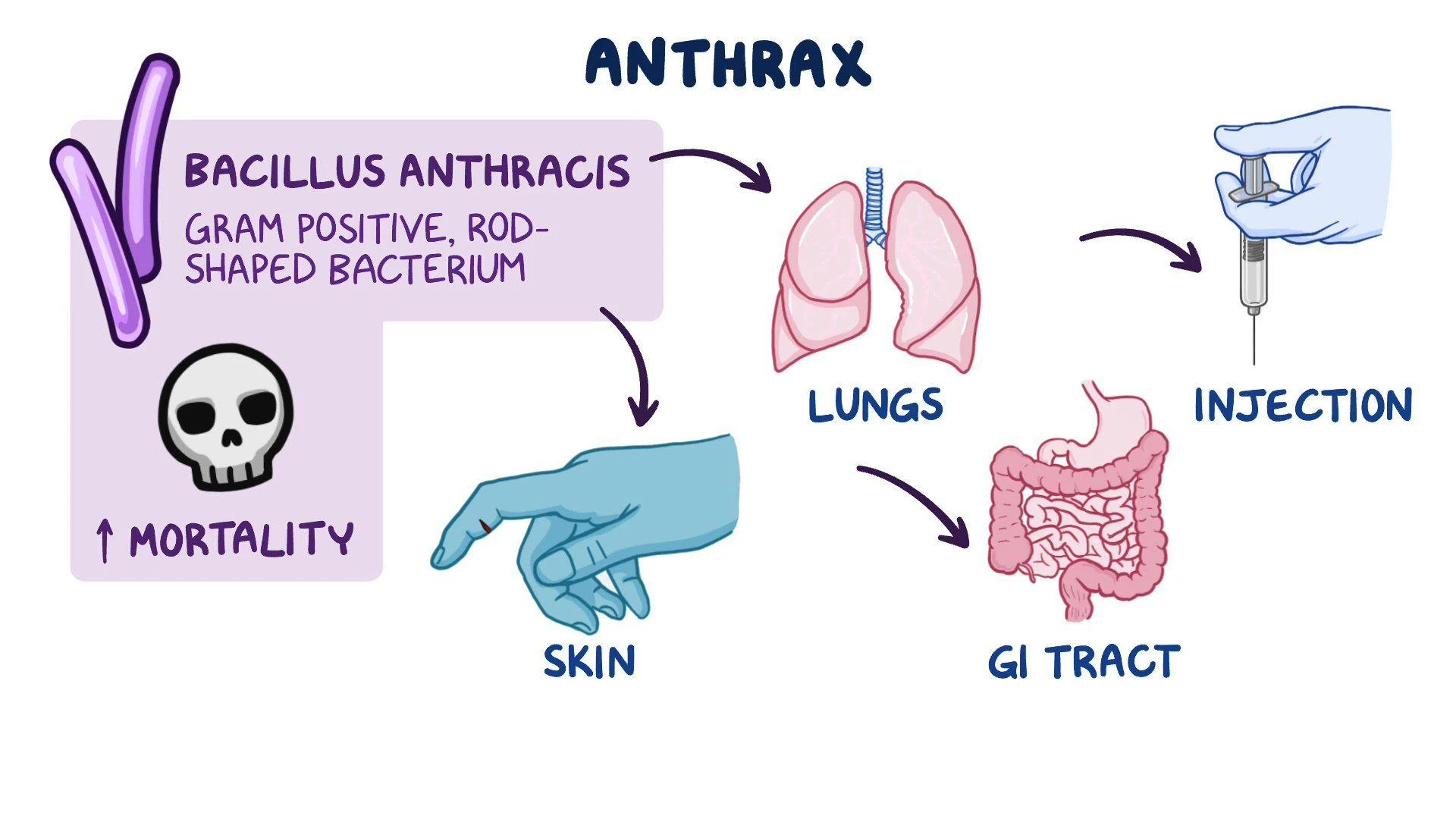 Unlocking Anthrax Disease Market: Key Considerations and Insights | DLI