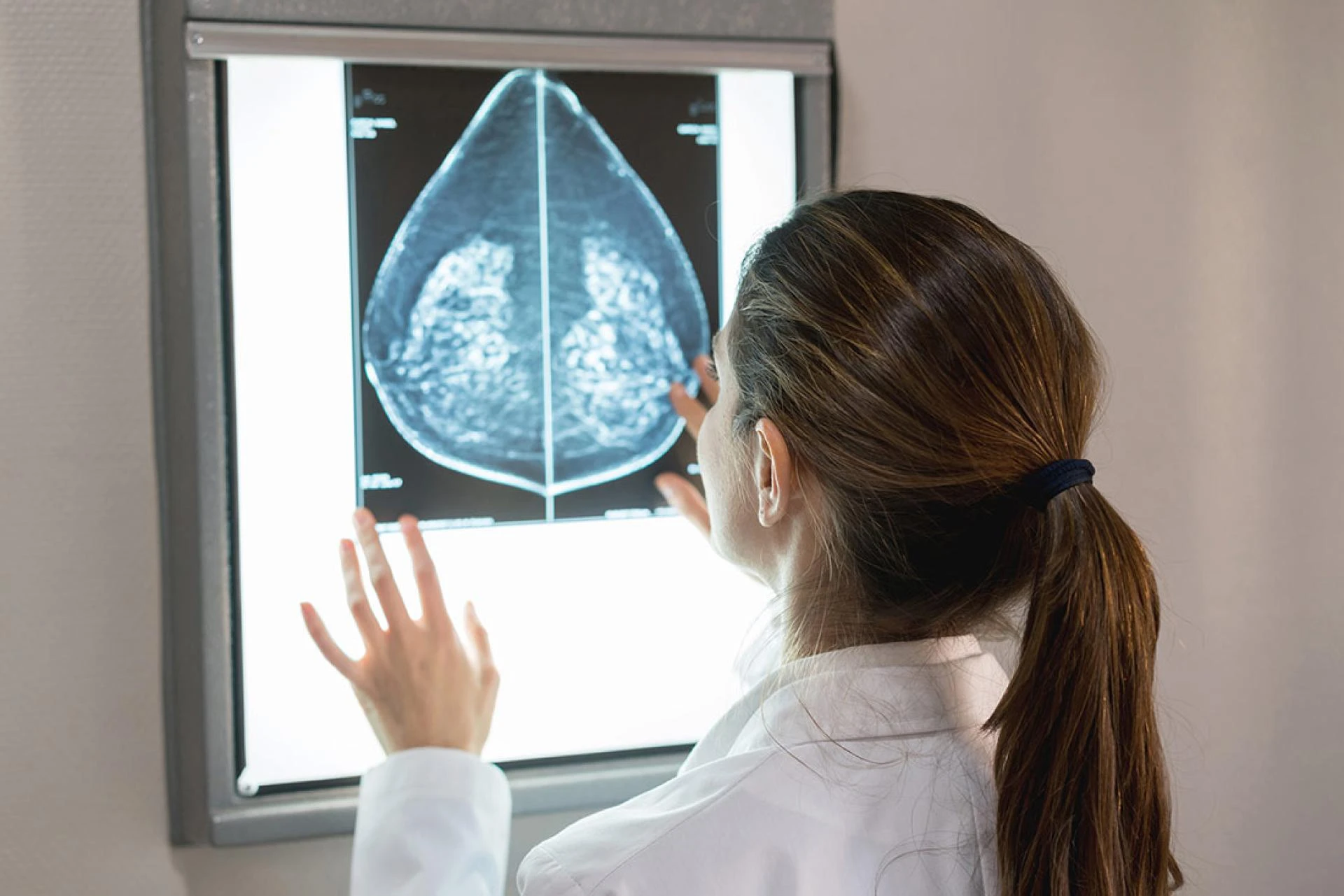 Epidemiology and Market Intelligence: A Winning Formula for Breast Cancer Success