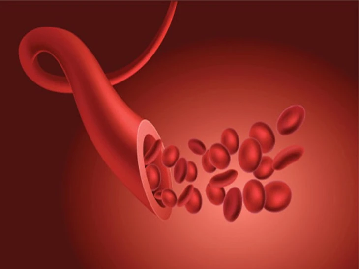 Navigating Anemia: KOL Perspectives, Epidemiology, and More