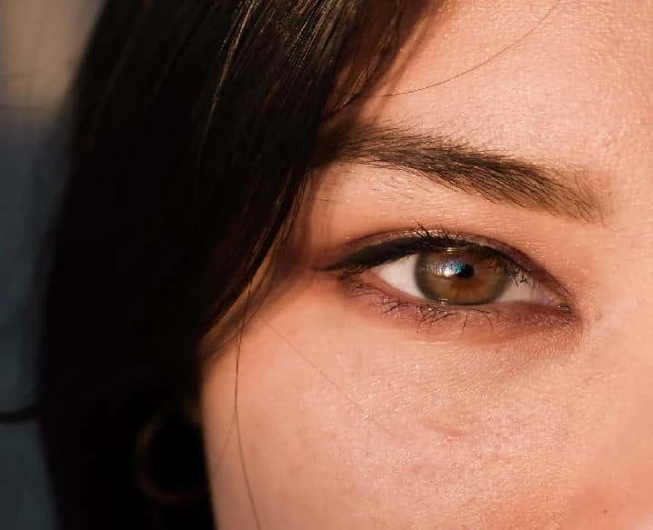 How to Get Rid of Dark Circles - Dadu Medical Centre