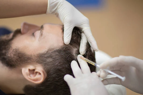 Common Hair Transplant Questions for Dubai Residents
