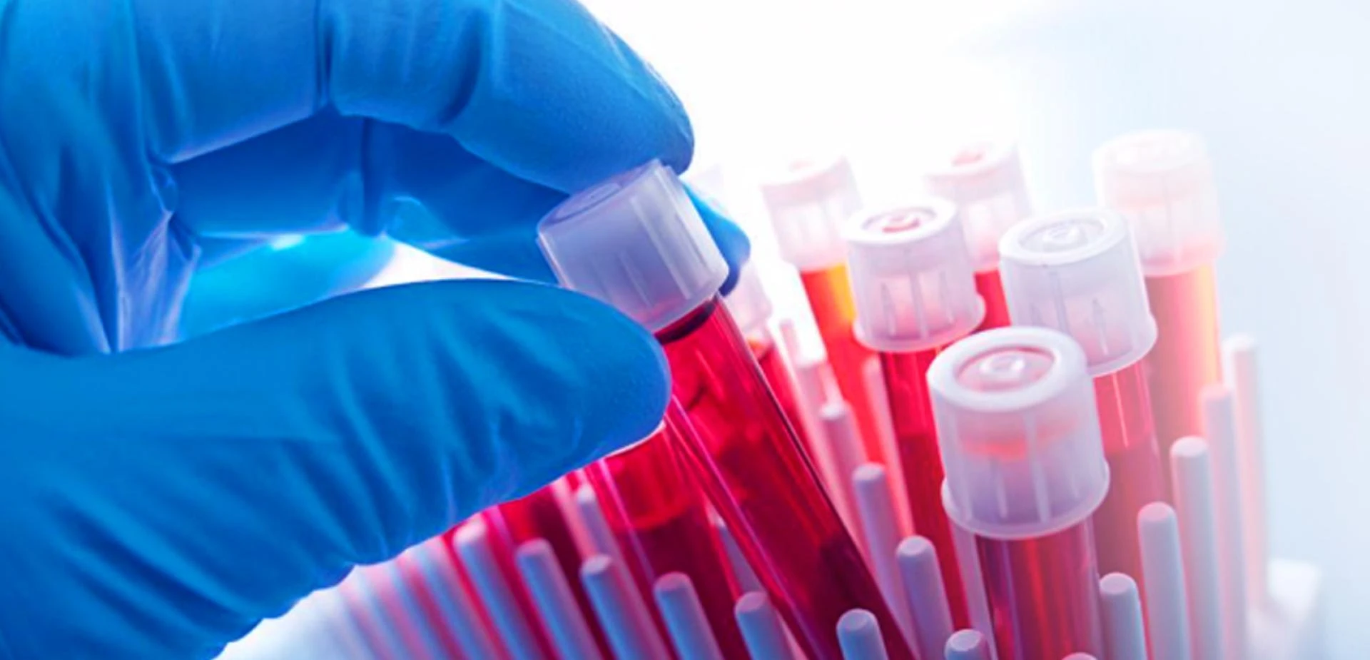 Hematology Analyzers and Reagents Market Growth Factors, And Regional Forecast by 2031