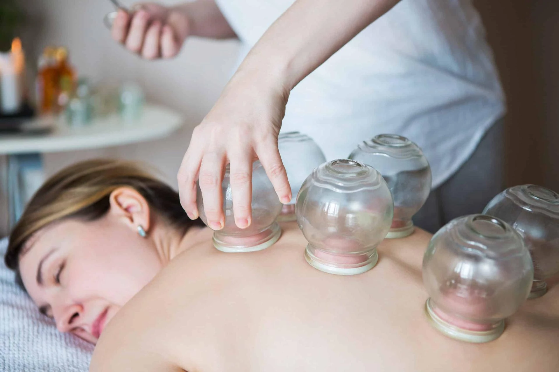 Book Cupping Therapy in Culver City