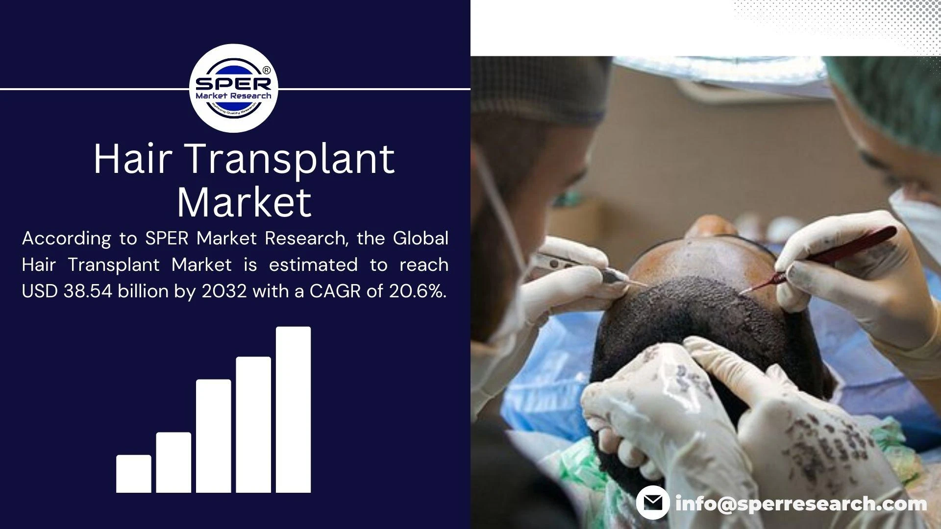 Hair Transplant Market Revenue, Growth, Covid-19 Impact, Industry Outlook, Trends, Global Report 2022-2032: SPER Market Research