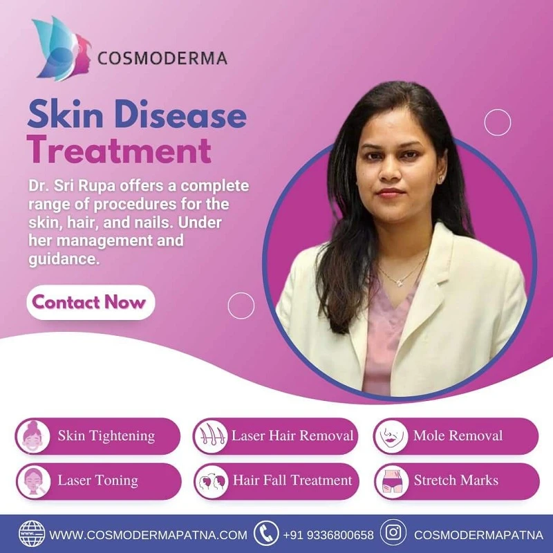 Best Dermatologists in Patna for Cosmetic Dermatology Services