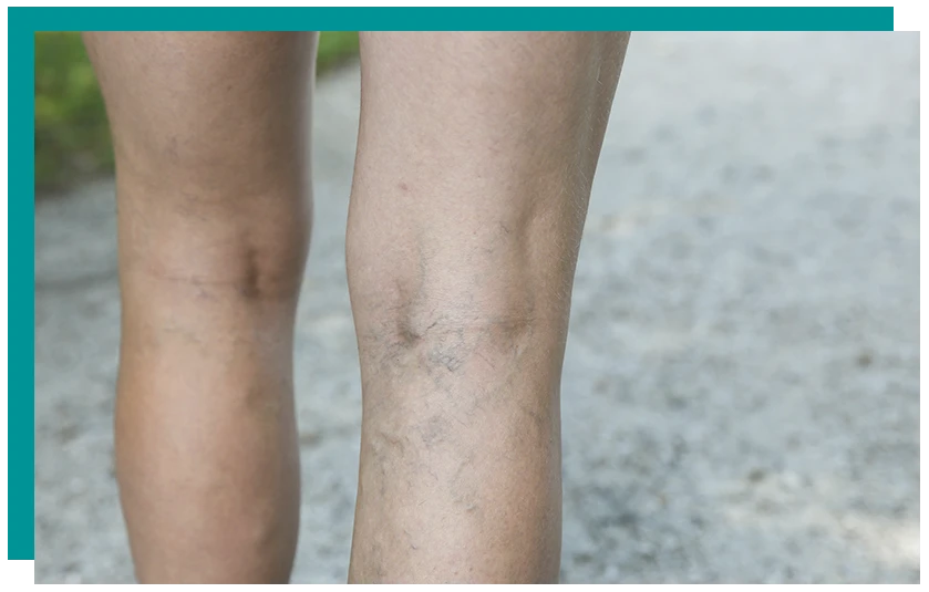 Everything You Need To Know About Laser Treatments