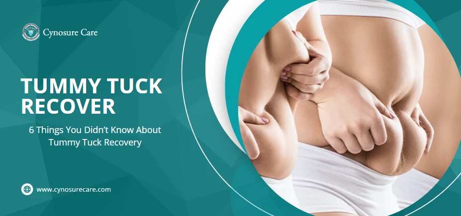 Lymphatic Massage After Tummy Tuck: Improving Your Recuperation