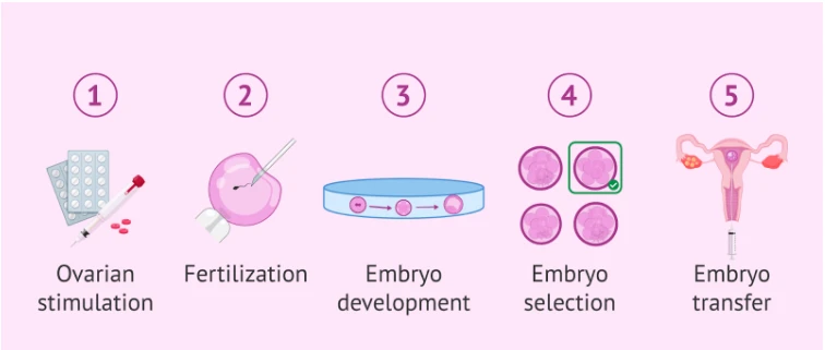 Common Risks and Side Effects of IVF Treatment Explained by IVF Specialists in Jaipur