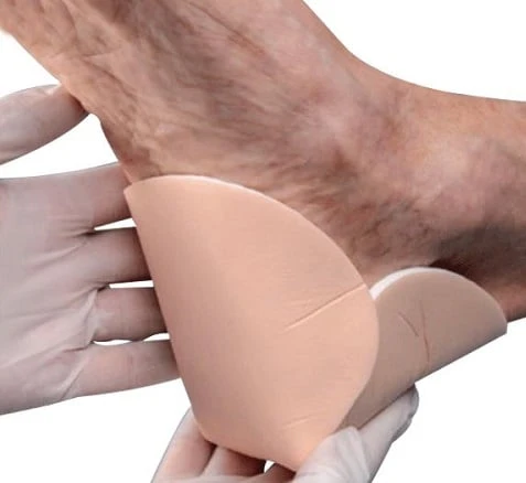 Demand for Foam Dressing Market to Witness Rapid Surge During the Period 2018–2026
