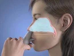 Nasal Drug Delivery Systems Market Projected To Be Resilient During 2026
