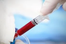 Blood Irradiation Market Structure And Its Segmentation For The Period 2026