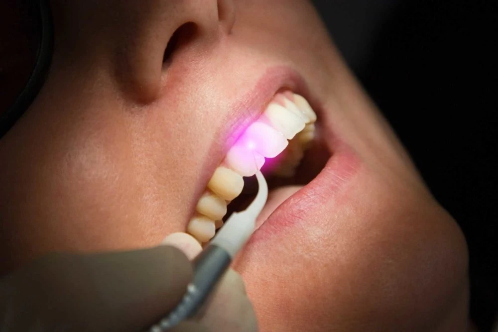 Intraoral Cameras Market: A Comprehensive Analysis of Trends and Growth Prospects