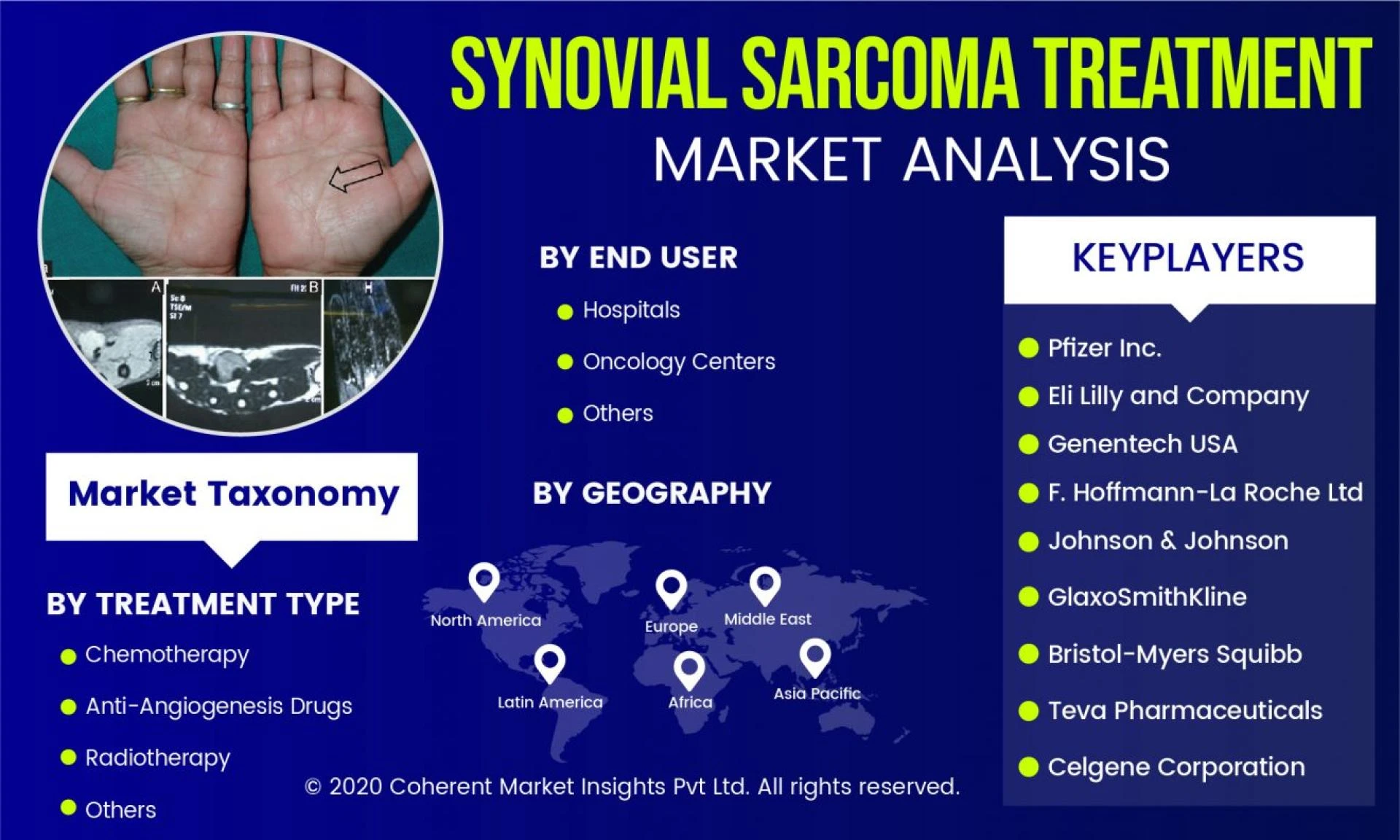 "A Comprehensive Study of the Synovial Sarcoma Treatment Market: Challenges and Opportunities"