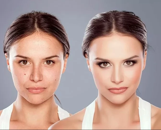 Facial Implants Market Growth Factors and Opportunities