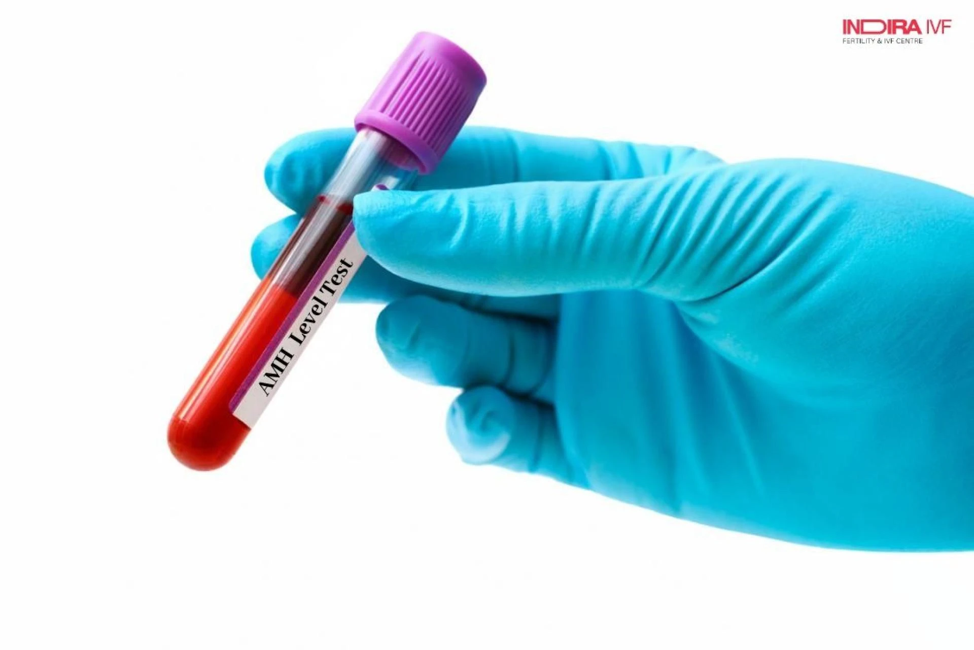 Is AMH Level Test 100% Reliable?