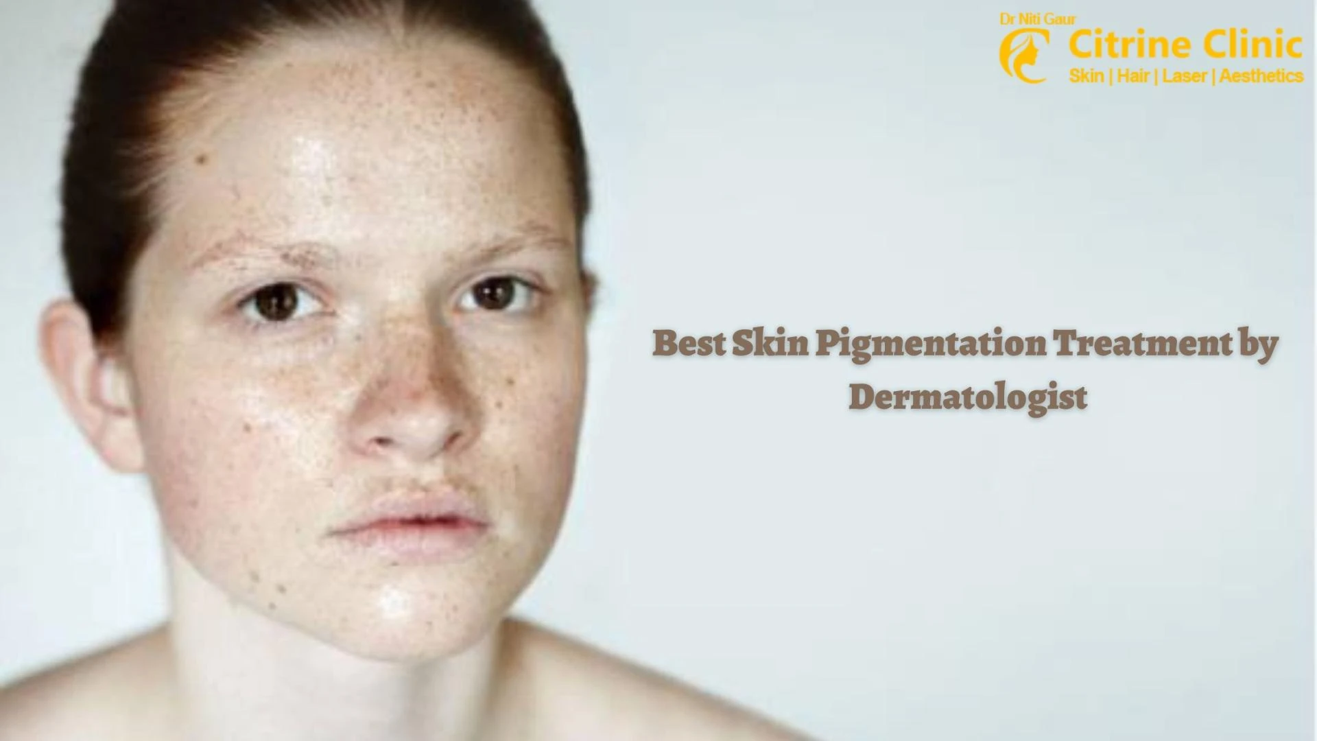 Best Skin Pigmentation Treatment by Dermatologist
