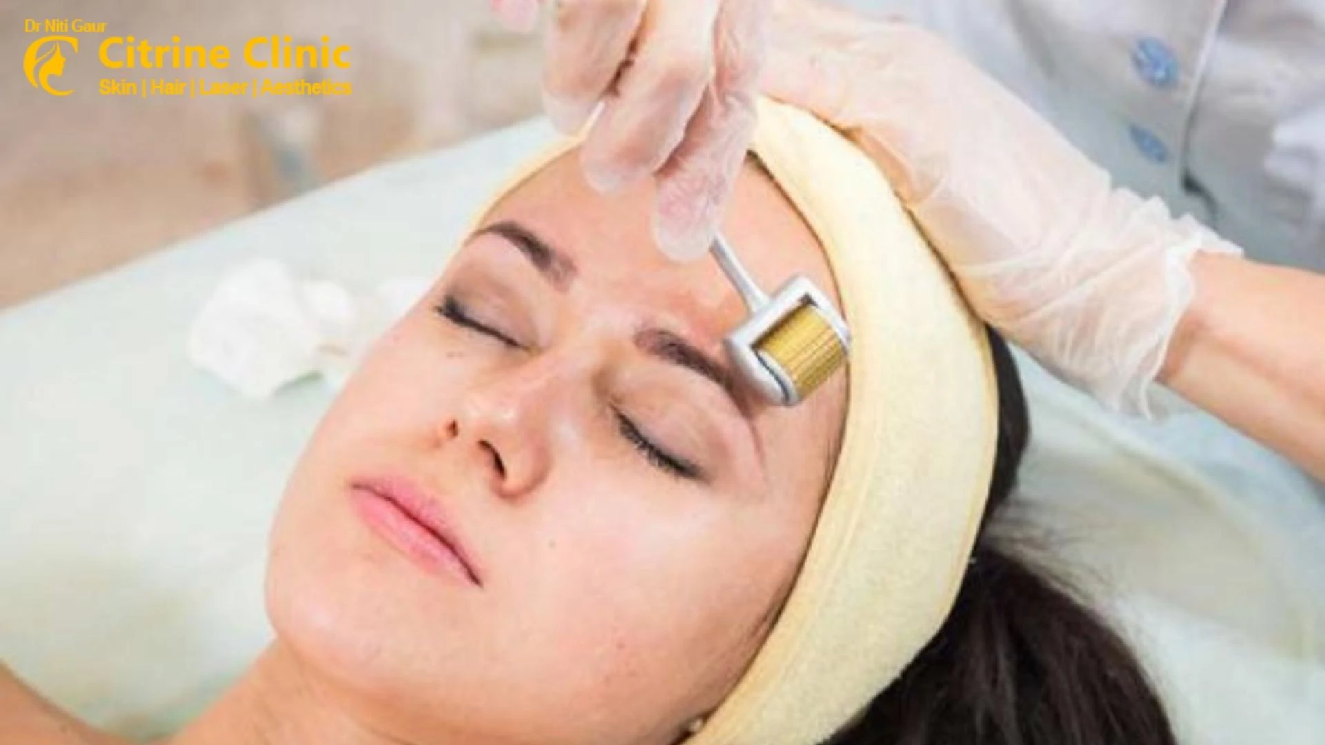 Acne Scar Treatment in Gurgaon : Citrine Clinic
