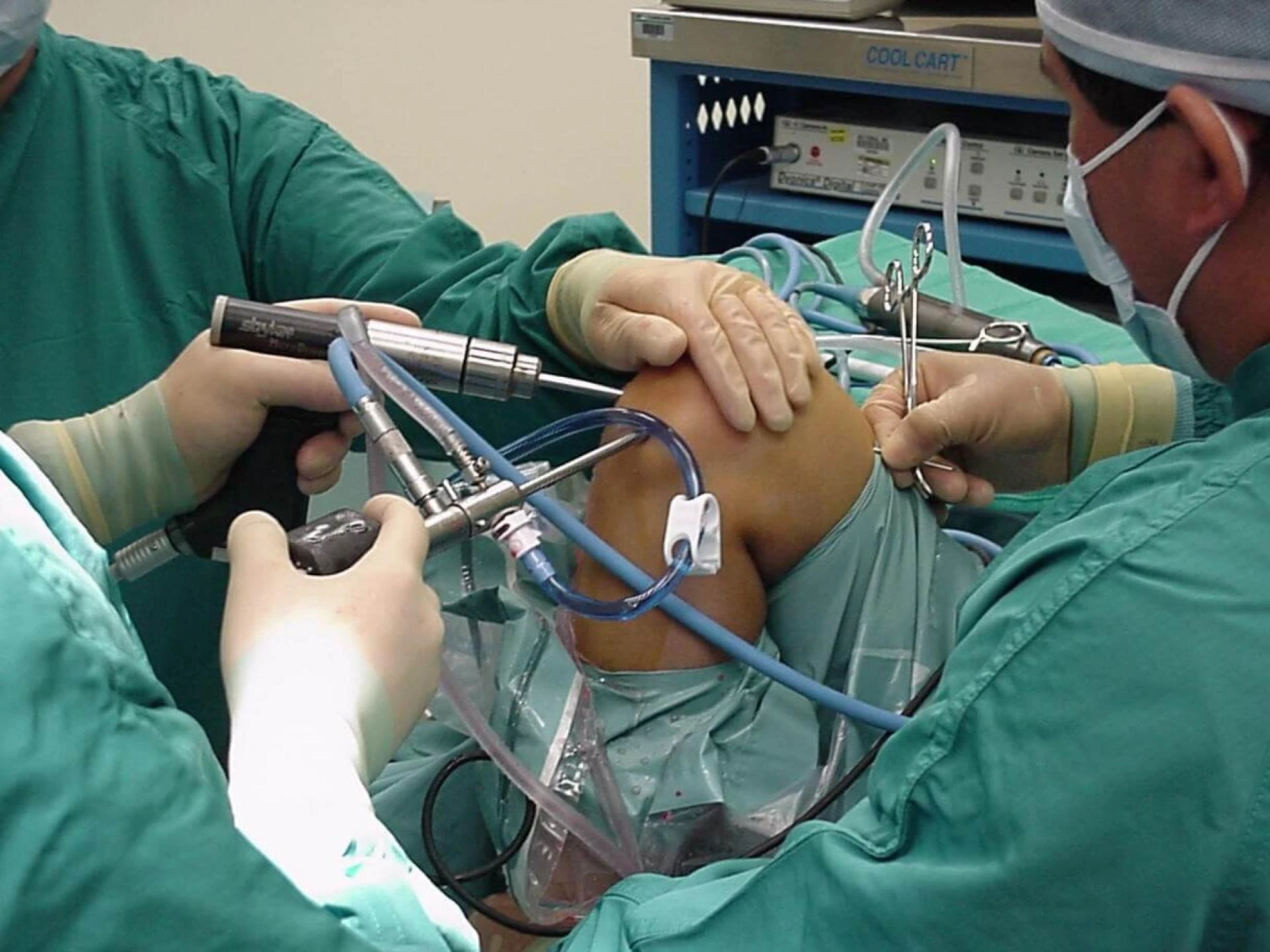 ACL Ligament Injury- Treatment Options, Surgery Costs, and Recovery Timeline