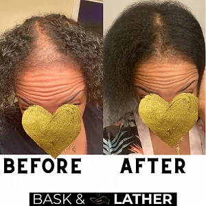 5 Tips to Help Kickstart Your Hair Growth Journey Back