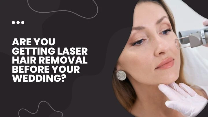 Are You Getting Laser Hair Removal Before Your Wedding?