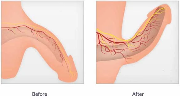 Vidalista 60 Mg–What is, Side effect – buymedlife