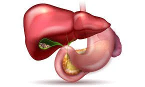 Gallbladder Stones: Causes, Symptoms, and Treatment Options