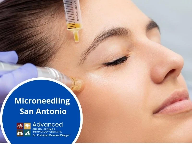 How Does Microneedling Treatment Aid In Skin Rejuvenations?