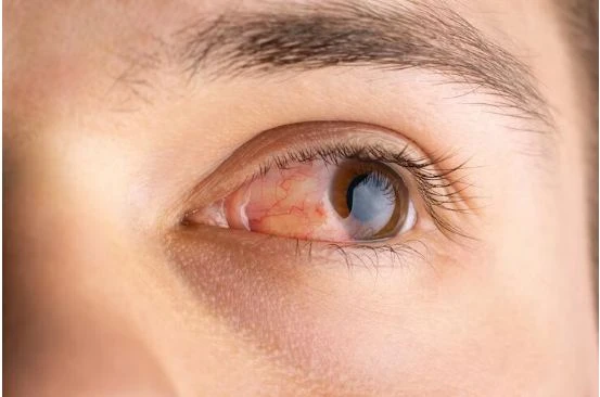 Diagnosis, treatment, and surgeries in Meerut | Jawahar Eye hospital