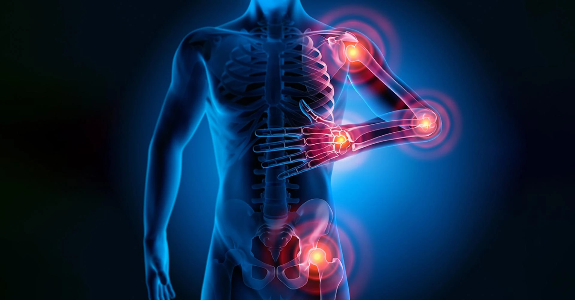 Global Fibromyalgia Treatment Market Is Estimated To Witness High Growth Owing To Increasing Awareness and Availability of Innovative Treatment Options
