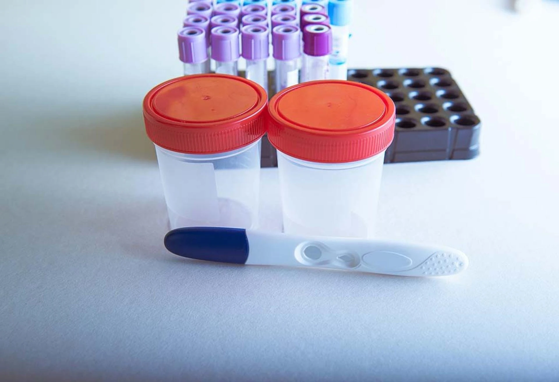 Human Chorionic Gonadotropin (HCG) Is Produced By Trophoblast Cells Around Developing Embryos