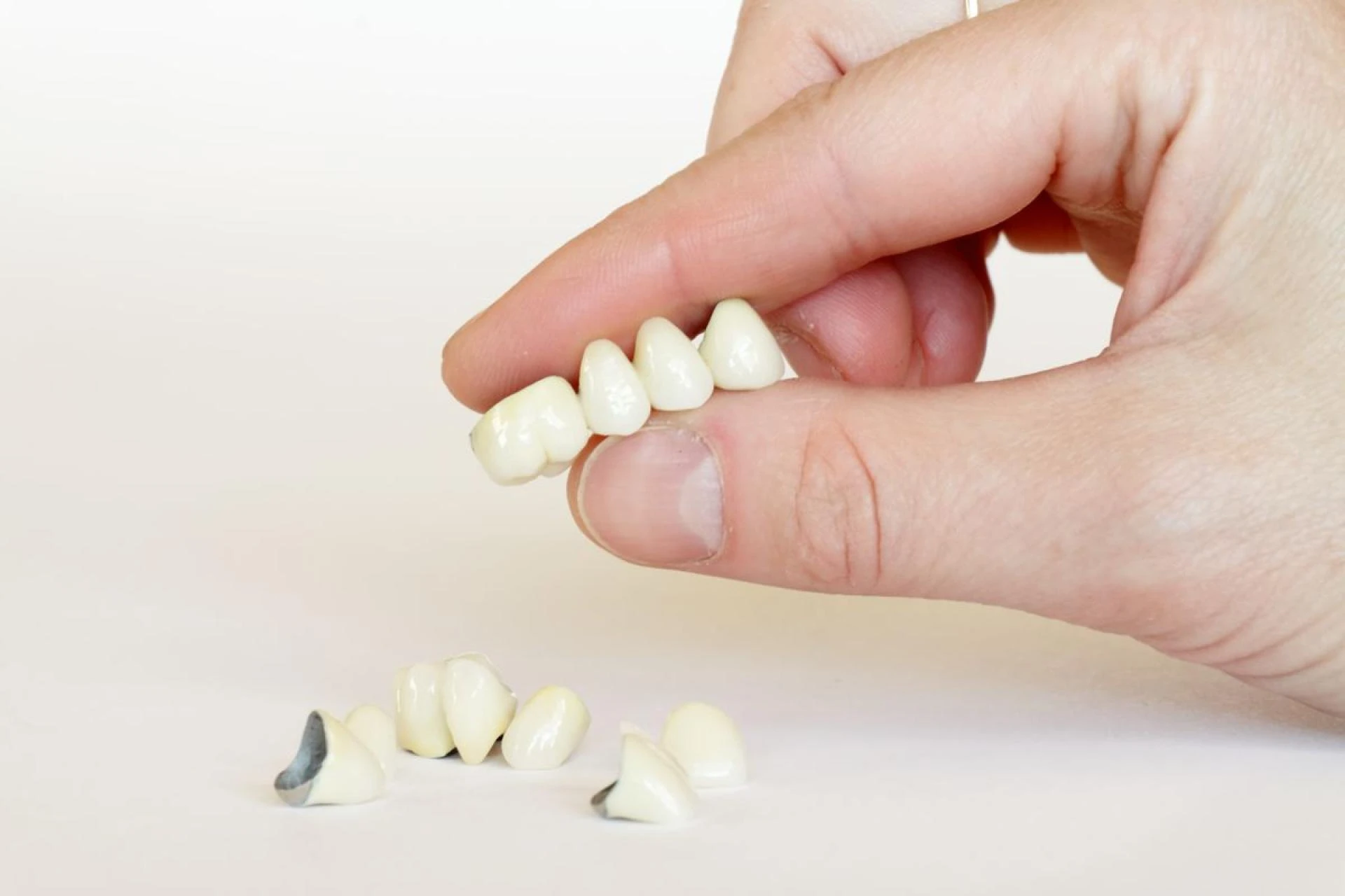 Porcelain Crowns - Are They Right For You?